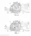 Fig. 09 - Bicycle component positioning device