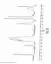 Fig. 23 - Hydrochloride salts of 8-[1-(3,5-bis-(trifluoromethyl)phenyl)-ethoxymethyl]-8-phenyl-1,7-diazaspiro[4,5]decan-2-one and preparation process therefor
