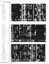 Fig. 05 - Albumin variants