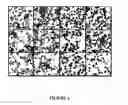Fig. 05 - Generation of patient-specific differentiated cell types by epigenetic induction