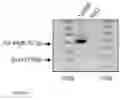 Fig. 04 - Restoration of the CFTR function by splicing modulation