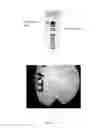 Fig. 06 - MYCOBACTERIUM COMPRISING EXPRESSION VECTOR WITH TWO AUXOTROPHIC SELECTION MARKERS AND ITS USE AS VACCINE