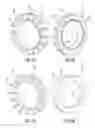Fig. 10 - Hydrocarbon resource heating system including common mode choke assembly and related methods