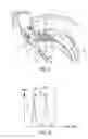 Fig. 06 - Turbine engine comprising a means for measuring the speed and torque of a shaft of the turbine engine and method for monitoring said shaft