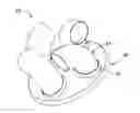 Fig. 01 - EXHAUST GAS FLOW DEVICE