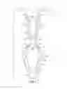 Fig. 02 - PLASTIC U-BASE FASTENER WITH NOISE CONTROL FEATURE