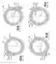 Fig. 03 - Hypoid Gear Set For Drive Axle