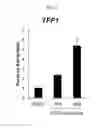 Fig. 08 - Biomarker TFF1 for predicting effect of C-MET inhibitor
