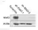 Fig. 08 - Compositions and methods for detecting and treating colorectal cancer