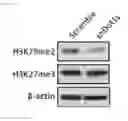 Fig. 11 - Compositions and methods for detecting and treating colorectal cancer