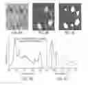 Fig. 10 - Method of reconstituting cellular spectra useful for detecting cellular disorders