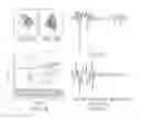 Fig. 17 - Method of reconstituting cellular spectra useful for detecting cellular disorders