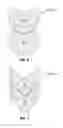 Fig. 06 - Fuel channel annulus spacer