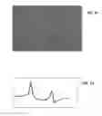 Fig. 57 - Ion sources, systems and methods