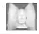 Fig. 01 - Pillow system providing sound suppression