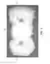 Fig. 07 - Pillow system providing sound suppression