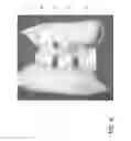 Fig. 08 - Pillow system providing sound suppression