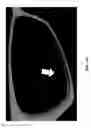 Fig. 95 - Methods And Apparatuses For Providing Laser Scanning Applications