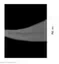 Fig. 96 - Methods And Apparatuses For Providing Laser Scanning Applications
