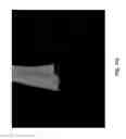 Fig. 98 - Methods And Apparatuses For Providing Laser Scanning Applications