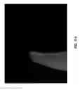 Fig. 99 - Methods And Apparatuses For Providing Laser Scanning Applications