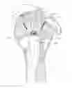 Fig. 01 - SUTURE ANCHOR