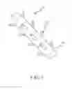 Fig. 02 - Material capturing guidewire