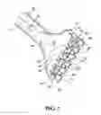 Fig. 02 - Ultrasonic debrider probe