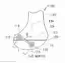 Fig. 01 - SYSTEMS AND METHODS FOR CORRECTING A ROTATIONAL BONE DEFORMITY