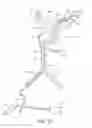 Fig. 02 - Apparatus and methods for treating pulmonary hypertension