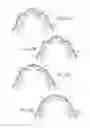Fig. 09 - APPARATUS AND METHOD FOR ORTHODONTIC TREATMENT