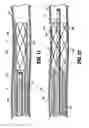 Fig. 09 - Thrombectomy catheter system with reference member