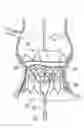 Fig. 01 - Systems for quickly delivering a prosthetic heart valve
