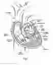 Fig. 02 - Systems for quickly delivering a prosthetic heart valve