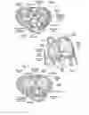 Fig. 03 - Systems for quickly delivering a prosthetic heart valve