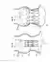 Fig. 04 - Systems for quickly delivering a prosthetic heart valve