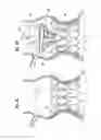 Fig. 05 - Systems for quickly delivering a prosthetic heart valve