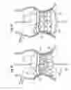 Fig. 06 - Systems for quickly delivering a prosthetic heart valve
