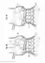Fig. 07 - Systems for quickly delivering a prosthetic heart valve
