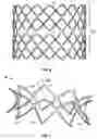 Fig. 06 - Collapsible-expandable prosthetic heart valves with structures for clamping native tissue