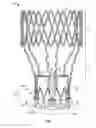 Fig. 02 - Collapsible-expandable prosthetic heart valves with structures for clamping native tissue