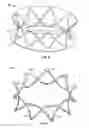 Fig. 07 - Collapsible-expandable prosthetic heart valves with structures for clamping native tissue