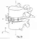 Fig. 03 - Expandable intervertebral implant