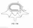 Fig. 22 - In-situ formed intervertebral fusion device and method