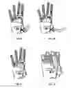 Fig. 09 - Modular and lightweight myoelectric prosthesis components and related methods