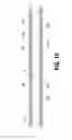 Fig. 07 - Catheter systems and methods for manufacture