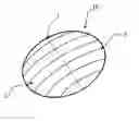 Fig. 01 - Intragastric balloon