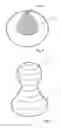 Fig. 05 - Intragastric balloon
