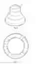 Fig. 06 - Intragastric balloon