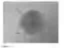 Fig. 02 - HEMORRHOIDAL DEVICE